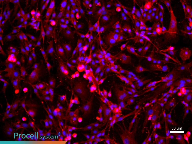 Mouse Cavernous Endothelial Cell Complete Medium - 1