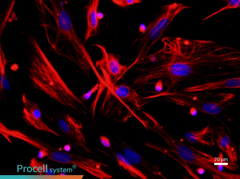 Rat Lung FibroblastsRat Lung Fibroblasts - 2