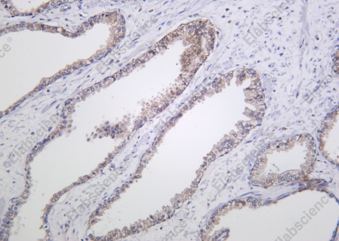 Recombinant Raf-B Monoclonal Antibody - 1