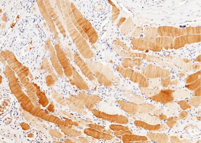 Recombinant PPM1G Monoclonal Antibody - small - 3