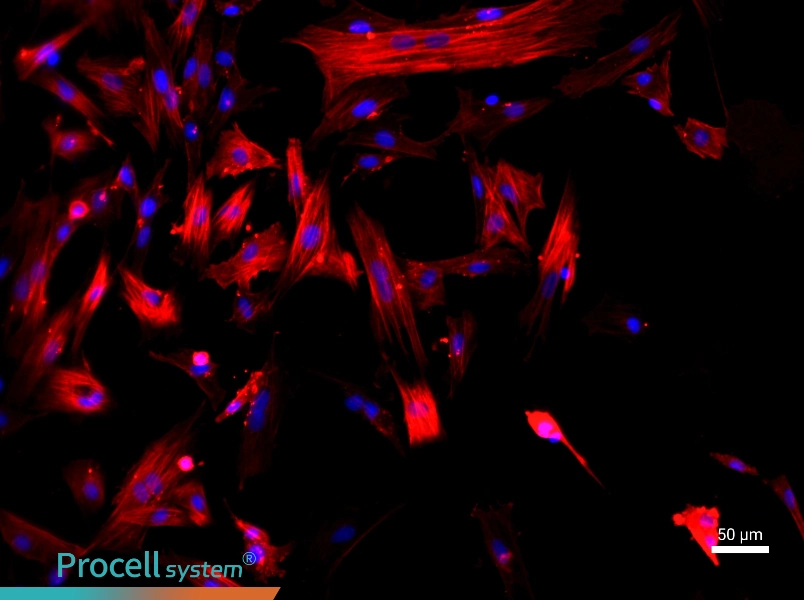 Rat Hepatic Stellate Cells - 1