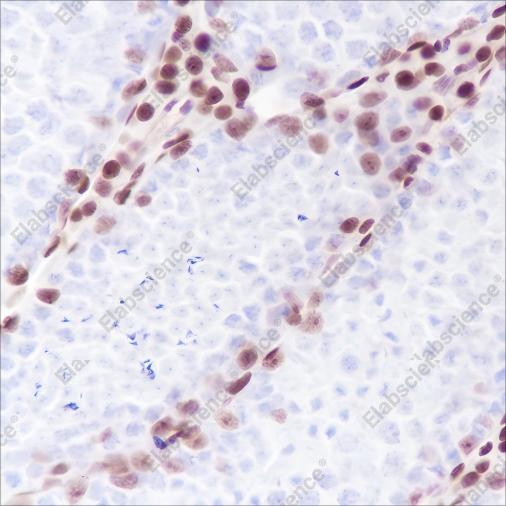 Recombinant Androgen Receptor (CT) Monoclonal Antibody - 4