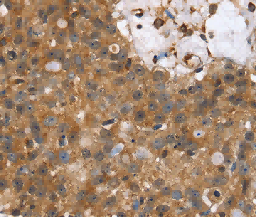 TPM2 Polyclonal Antibody - 3
