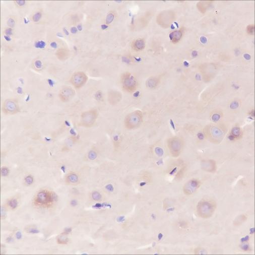 Recombinant Dynamin 1 Monoclonal Antibody - small - 4