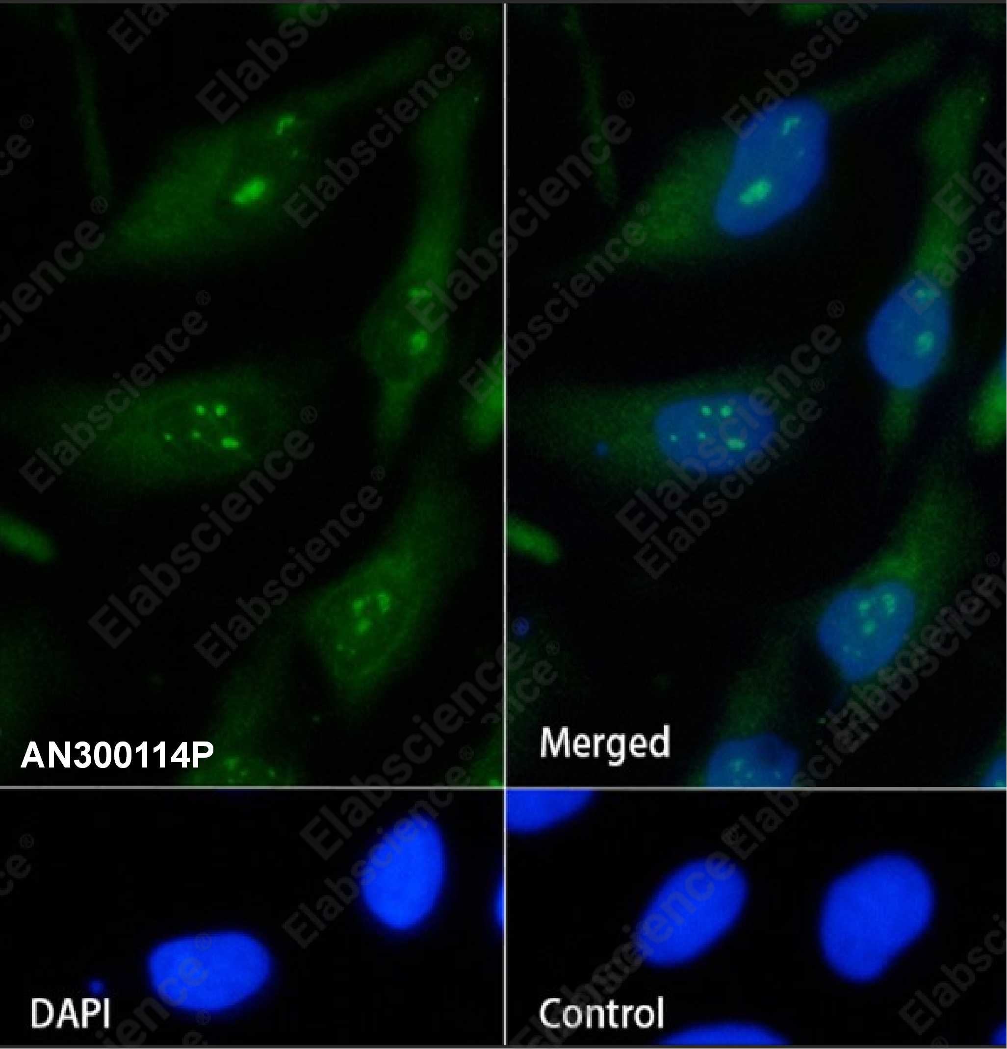 Recombinant S100A1 Monoclonal Antibody - 2