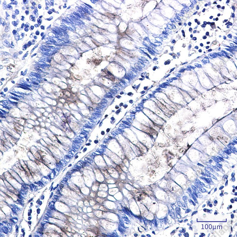Recombinant Entactin Monoclonal Antibody - 2