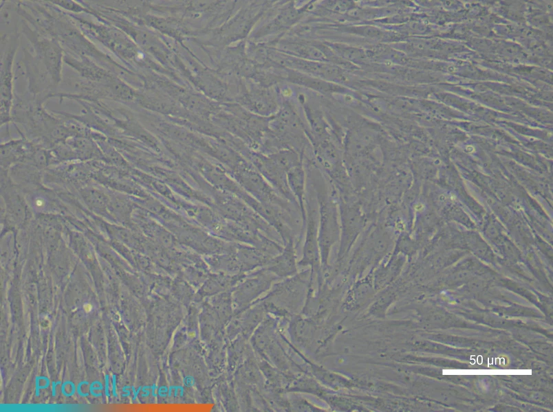 Human Synovial Cell Complete Medium - 6