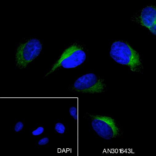 Recombinant Phospho-PTP1B (Ser386) Monoclonal Antibody - small - 3