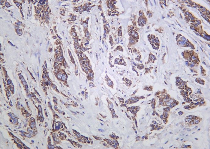 Recombinant G3BP1 Monoclonal Antibody-searchlist-1