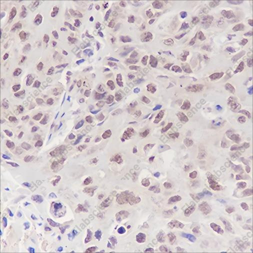 Recombinant RBBP4 Monoclonal Antibody - 2