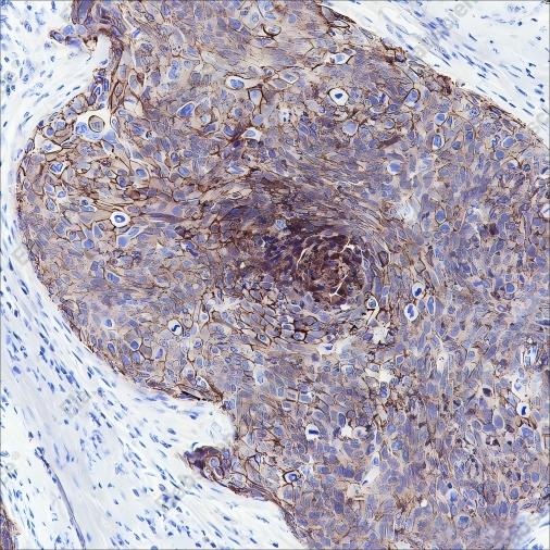 Recombinant PI3 Kinase p110 alpha Monoclonal Antibody - 3