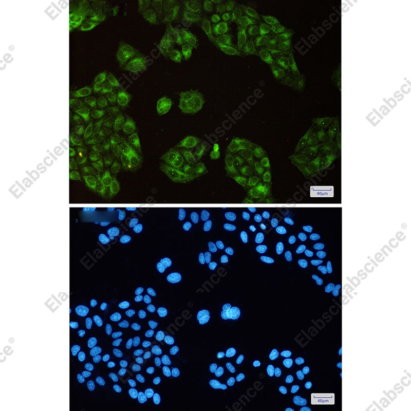 Recombinant SCD1 Monoclonal Antibody - 2