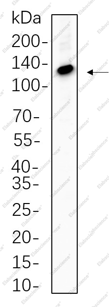 Recombinant ATP-Citrate Lyase Monoclonal Antibody - 1