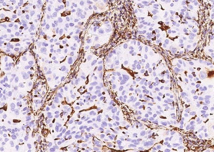 Recombinant Vimentin/VIM Monoclonal Antibody - small - 3