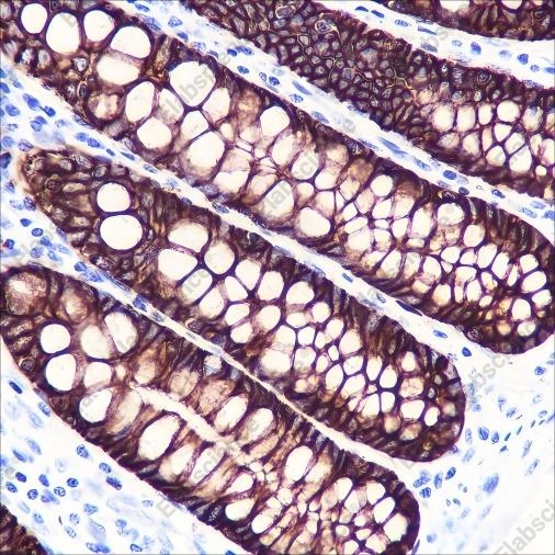 Recombinant GPA33 Monoclonal Antibody - 2