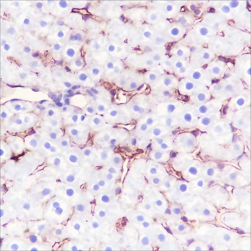 Recombinant MHC Class I Monoclonal Antibody - small - 4