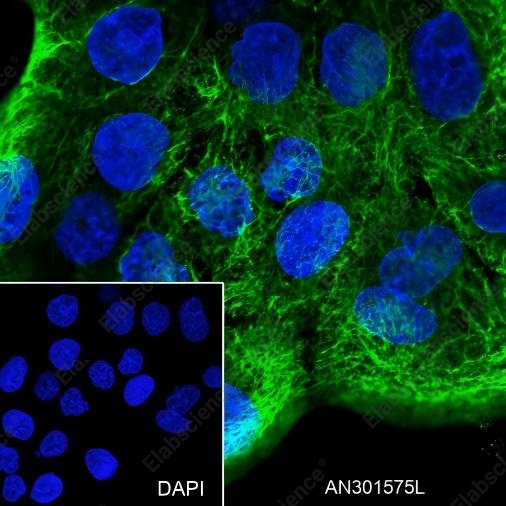 Recombinant Keratin 16 Monoclonal Antibody - 4