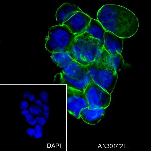 Recombinant Na+/K+ ATPase alpha-1 Monoclonal Antibody - small - 5