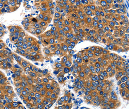 IGF2BP1 Polyclonal Antibody - 2