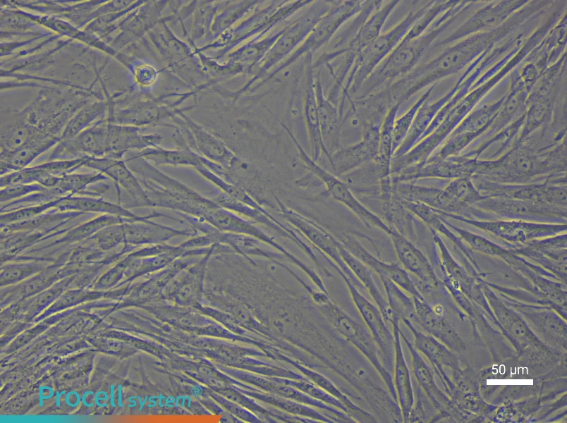 Human Vascular Adventitial Fibroblast Complete Medium - 5