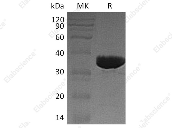 Recombinant Human GALM Protein (His Tag) - 1