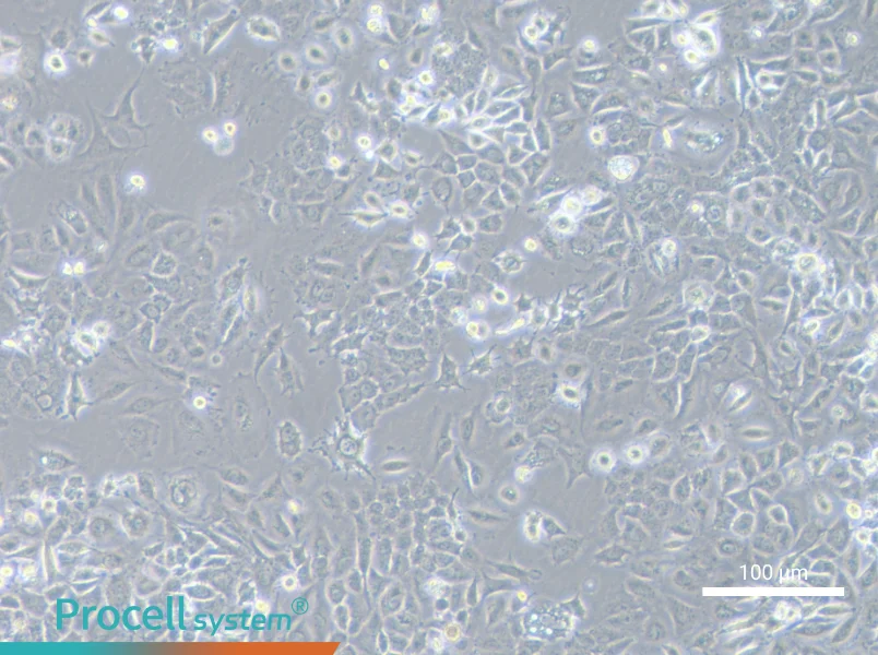 NCI-H2172NCI-H2172 - 2