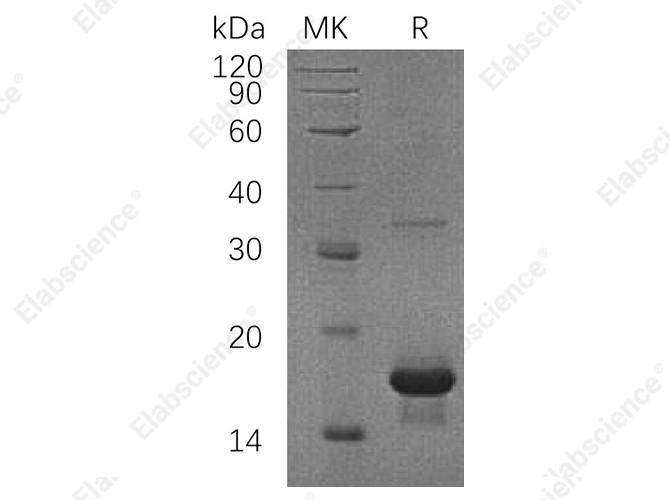 Recombinant Human SH2D1A/SAP Protein (His Tag) - 1