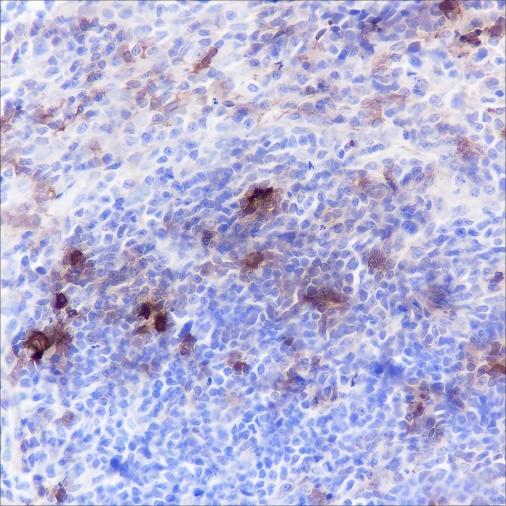 Recombinant B7-H3/CD276 Monoclonal Antibody - small - 5