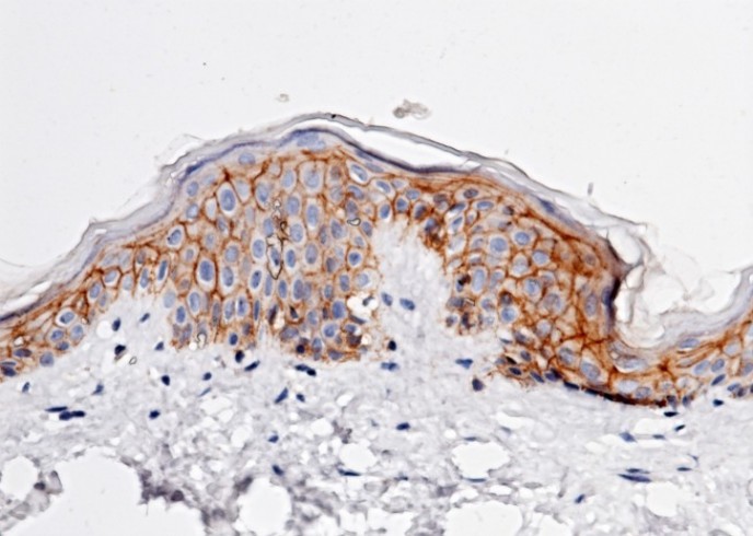 Recombinant E-Cadherin/CDH1/E-cad/CD324 Monoclonal Antibody - small - 2