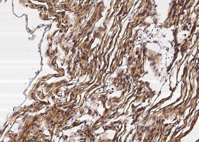 Recombinant Neuropilin-1/NRP1/CD304 Monoclonal Antibody - small - 2