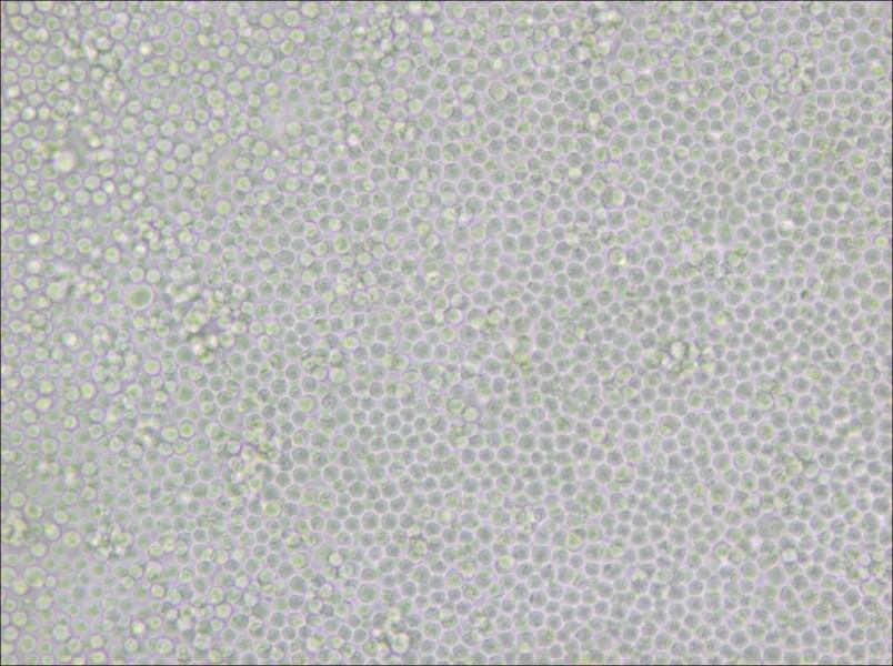 P388D1 Cell Complete Medium - 4