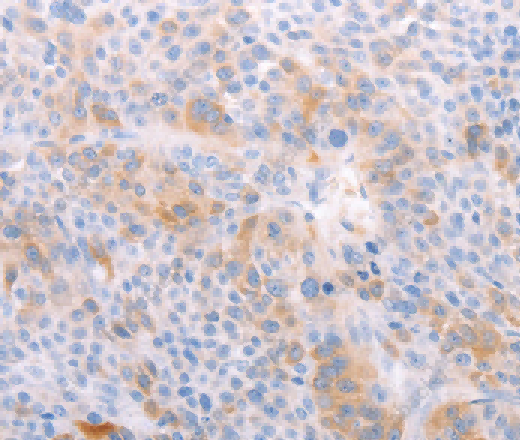 EDG6 Polyclonal Antibody - 2