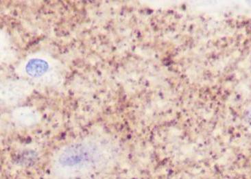 Recombinant SV2A Monoclonal Antibody-searchlist-2