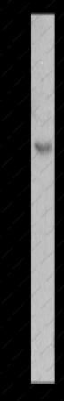 MC5R Polyclonal Antibody - 1