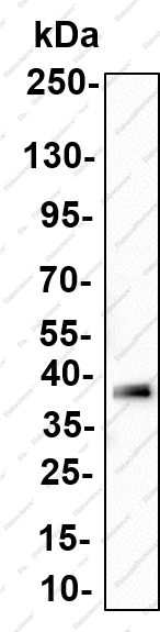 Recombinant PKA α/β/γ (Phospho Thr197) Monoclonal Antibody - 1