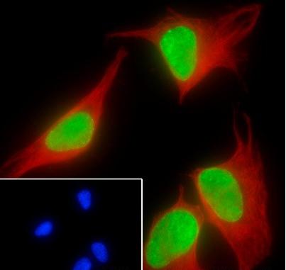 Recombinant Histone H3 (Di Methyl Lys14) Monoclonal Antibody - small - 5
