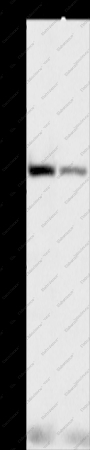 NFE2L1 Polyclonal Antibody - 1