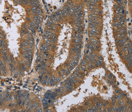 HSP40-4 Polyclonal Antibody - 2