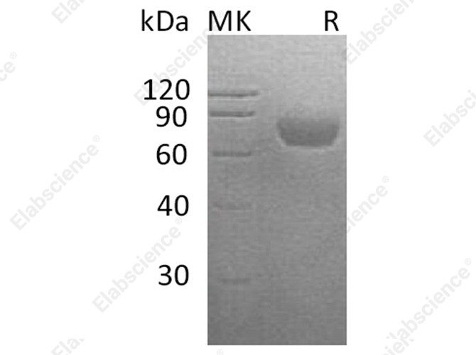 Recombinant Human CD48 Protein (His Tag) - 1