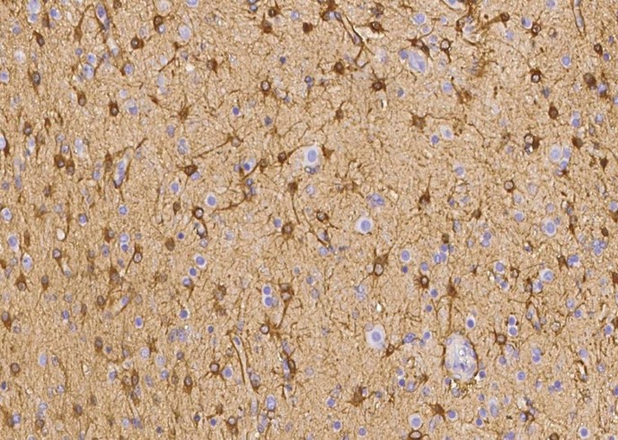 Recombinant Ezrin/villin 2 Monoclonal Antibody-searchlist-1