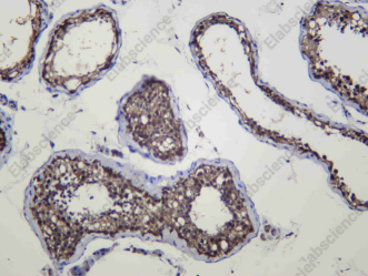 Recombinant PCBP2 Monoclonal Antibody - 1
