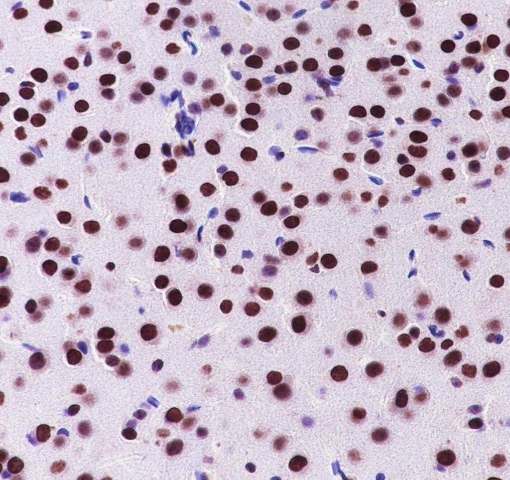 Recombinant Nucleolin Monoclonal Antibody - small - 4