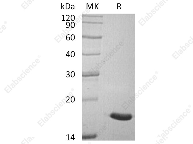 Recombinant Human ACP1/LMW-PTP Protein (His Tag) - 1