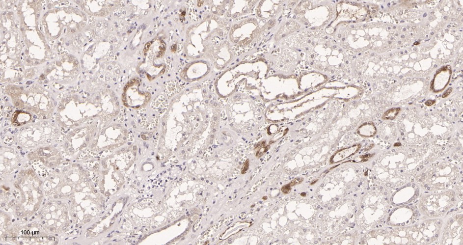 Recombinant NQO1 Monoclonal Antibody - small - 2