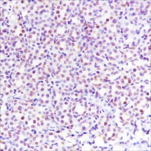Recombinant Ataxin-3 Monoclonal Antibody - small - 3