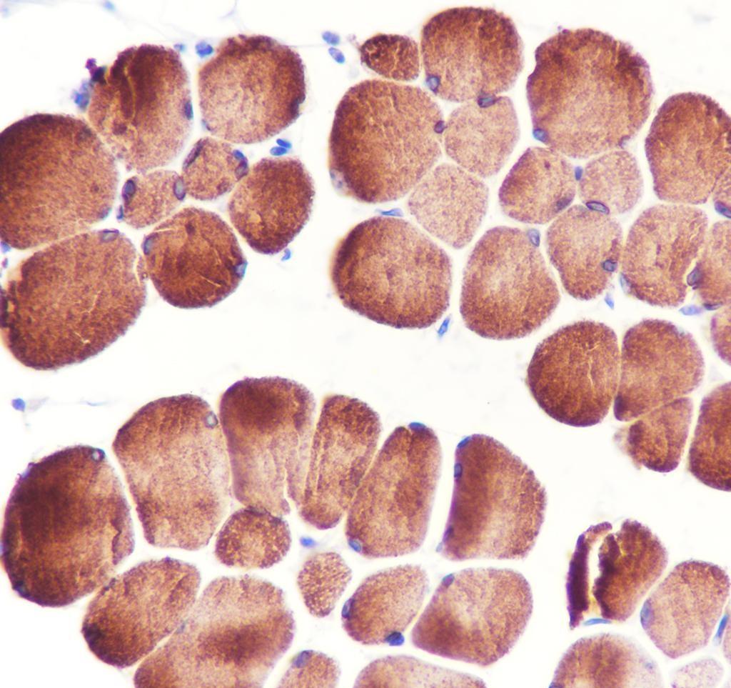 Recombinant Ryanodine Receptor Monoclonal Antibody - small - 2