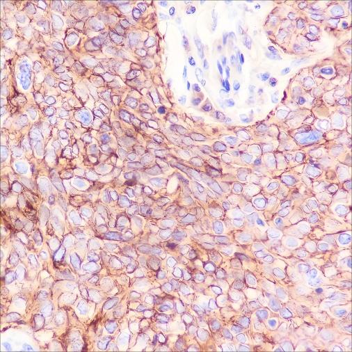 Recombinant Na+/K+ ATPase alpha-1 Monoclonal Antibody - 2