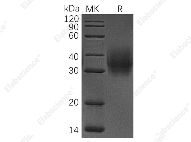Recombinant Human CD47/IAP Protein (His Tag) - 1