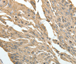 HSP90B1 Polyclonal Antibody - 2