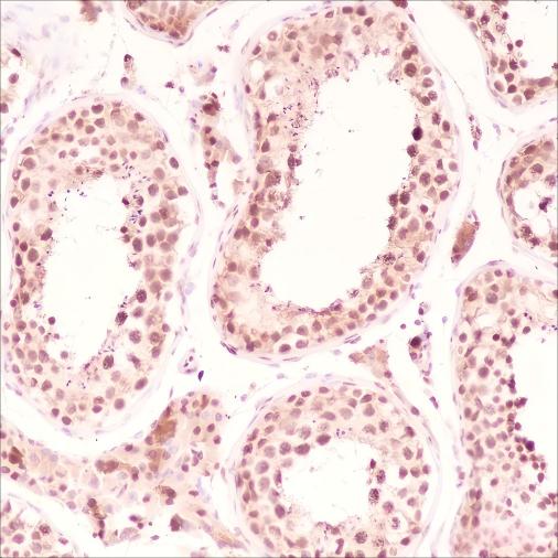 Recombinant SF1 Monoclonal Antibody - 2